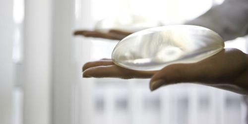 Cancer and breast implants: several deaths in the United States