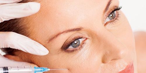 Aesthetic medicine: all about collagens and hyaluronic acid filler wrinkles