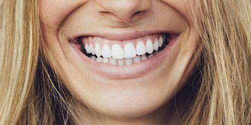 Smile, by 2020 your dental care will be 100% reimbursed